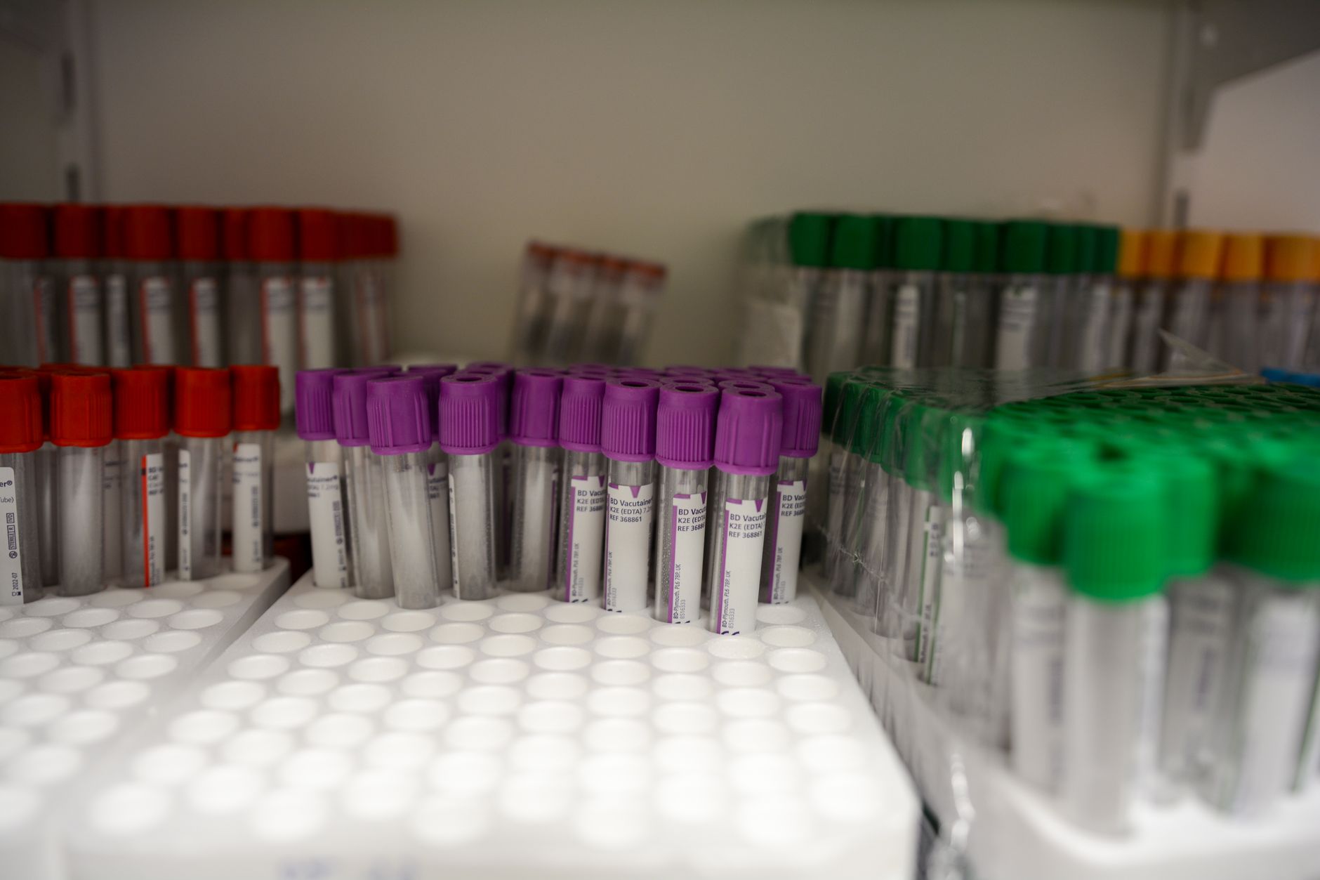 Close-up of labeled blood collection tubes in a laboratory with red, purple, and green caps.